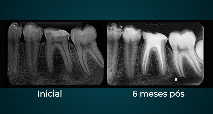 Endodontia