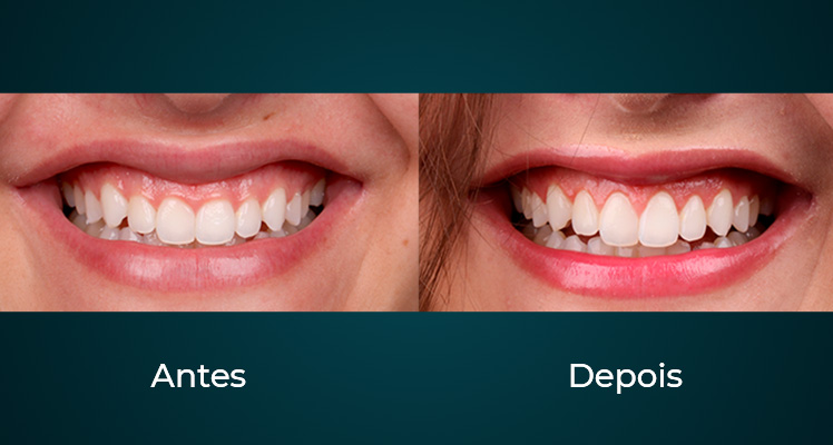 Periodontia